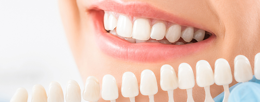 Cosmetic Dentist Modesto | Affordable Cosmetic Dentistry