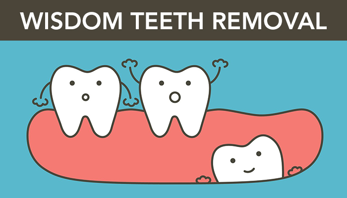 wisdom-tooth-removal