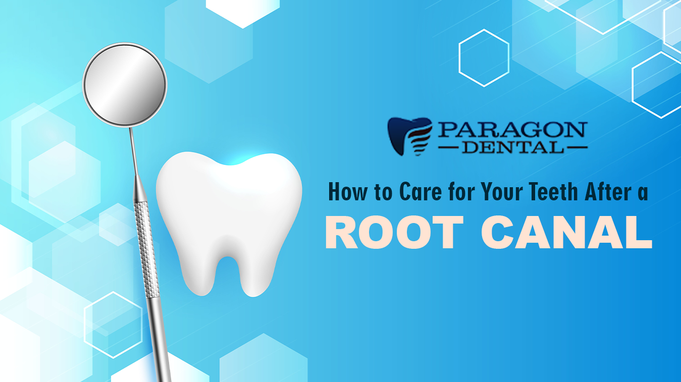 How to Care for Your Teeth After a Root Canal