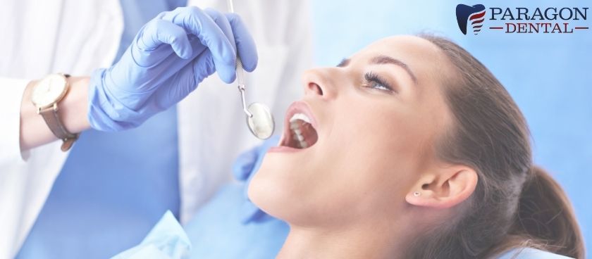 7 The Most Common Myths of a Root Canal