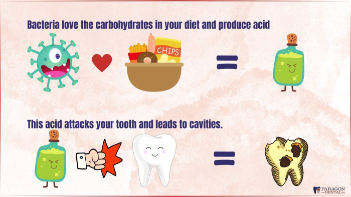 tooth cavity process