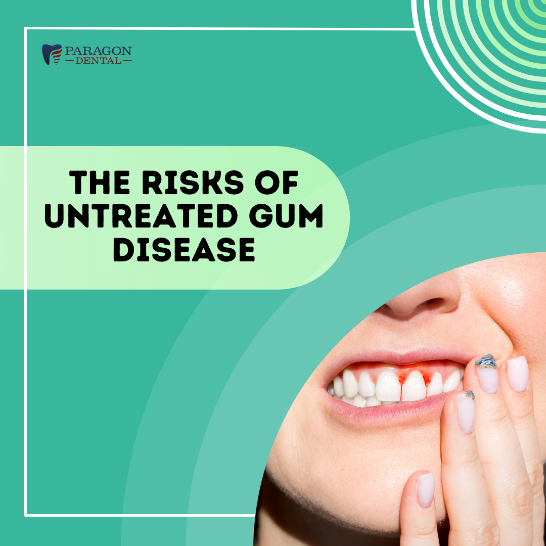 The Risks of Untreated Gum Disease