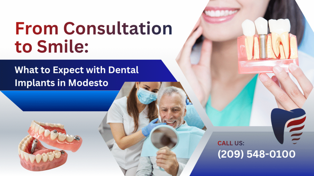 What to Expect with Dental Implants in Modesto