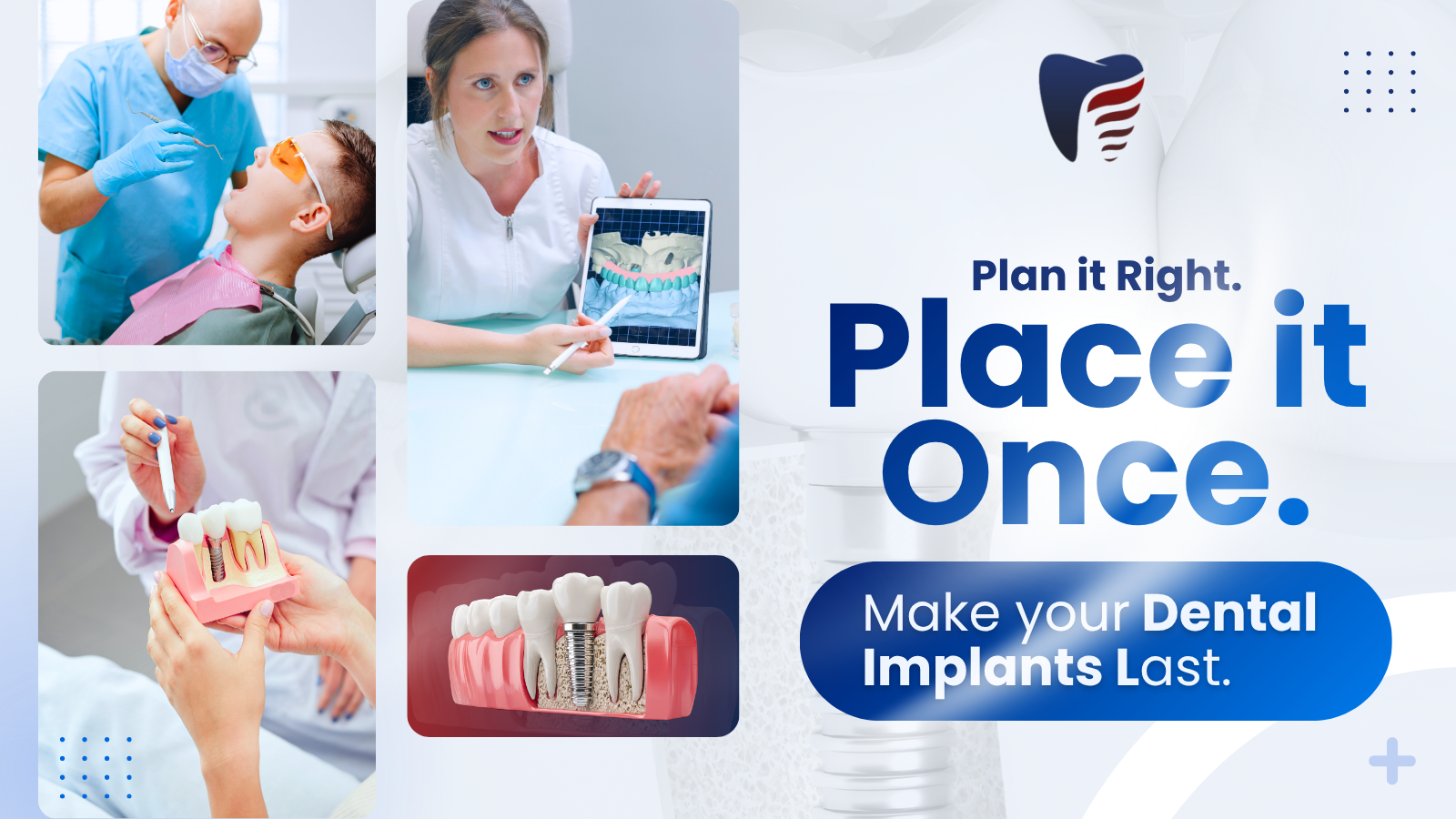 dental-implants-modesto-procedure-recovery-guide