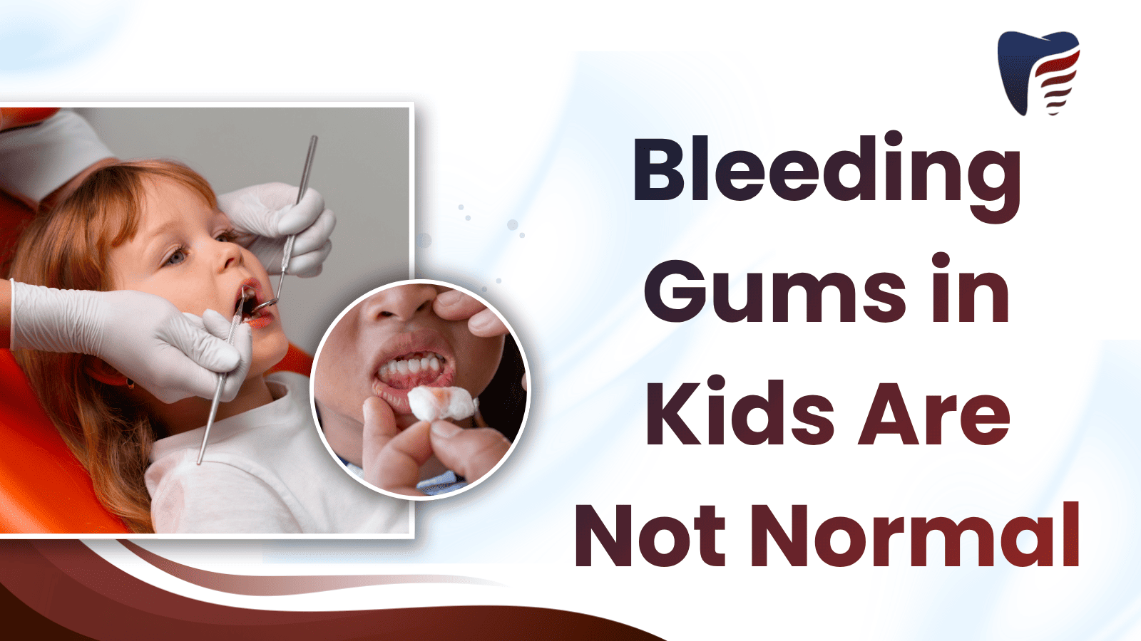 prevent-gum-problems-pediatric-dentistry-modesto