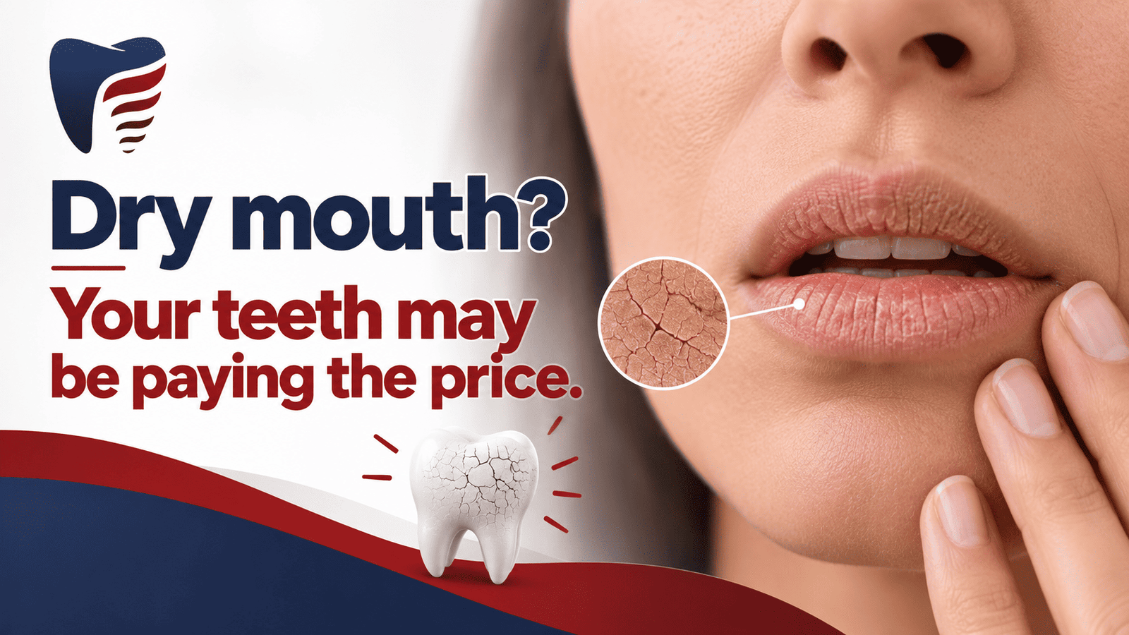 dry-mouth-saliva-teeth-gums